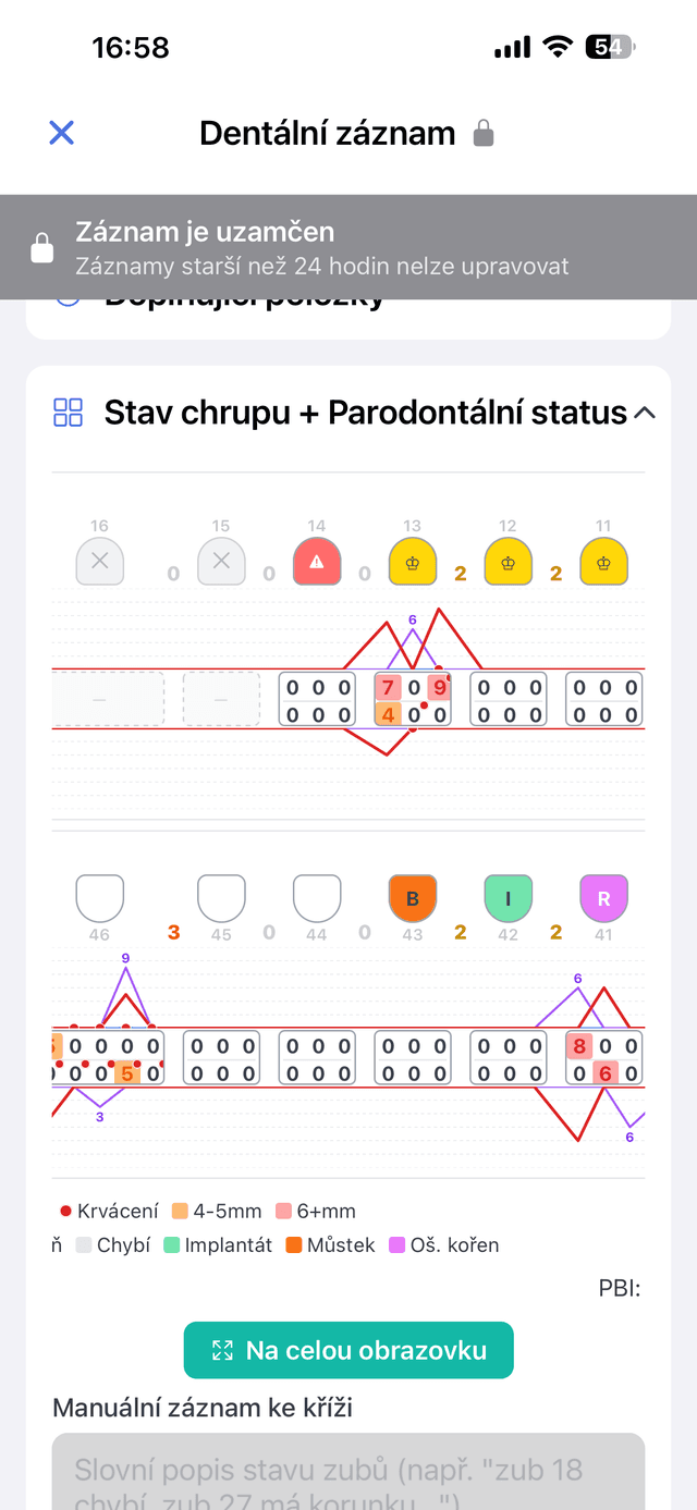EDOWhisper - Dentalni zaznam